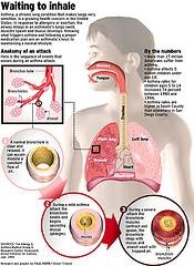 asthma_how_it_works